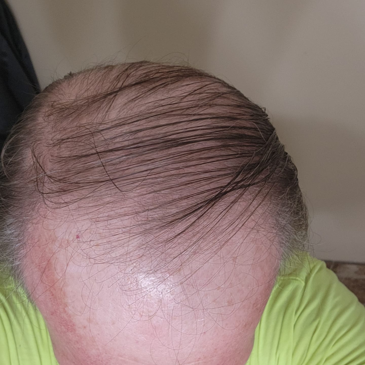 Customer photo review of Spartan™ Root Activator Shampoo 6 Bottles(sc)