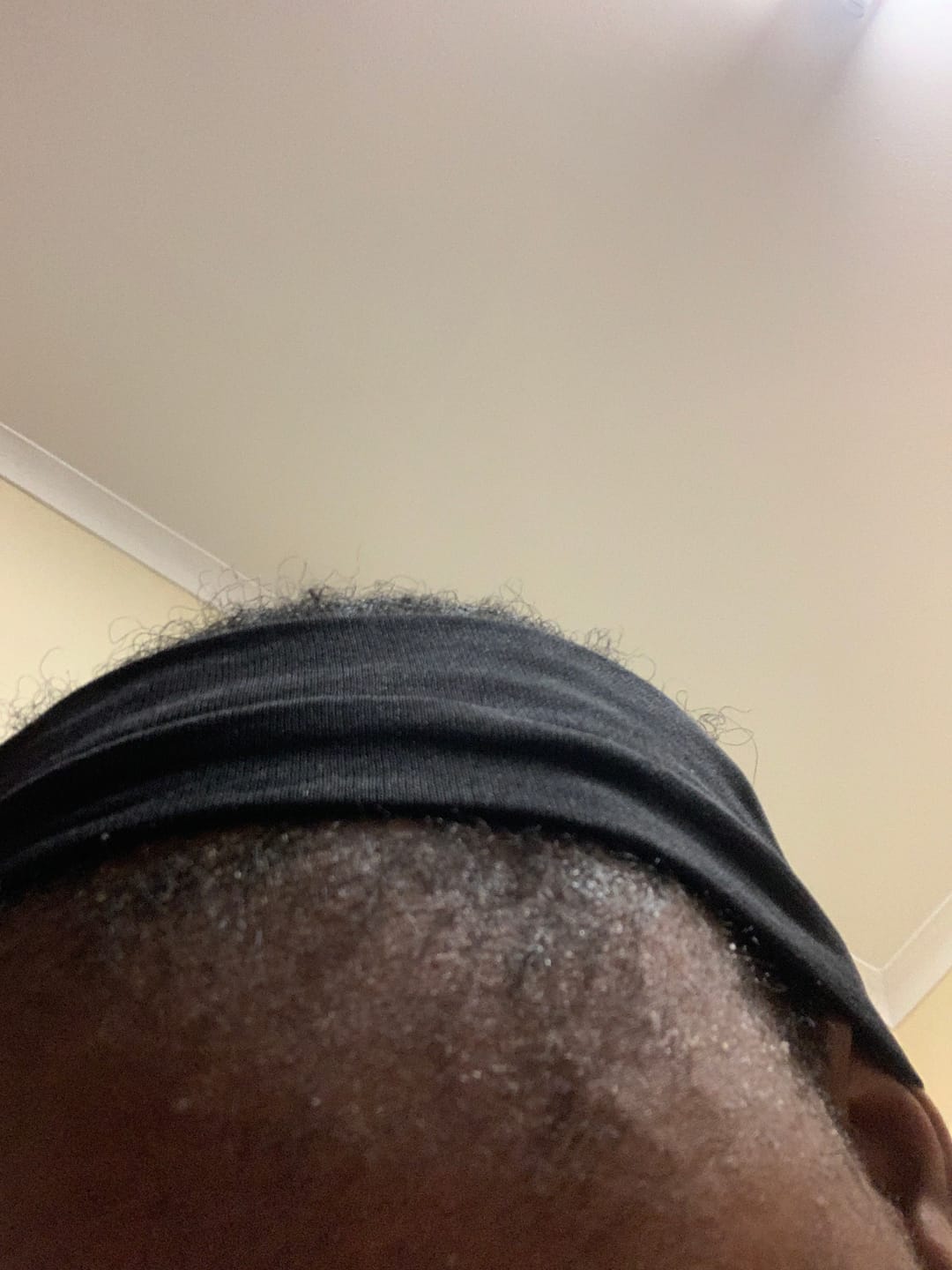 Customer photo review of Minoxidil 5% Solution, 1 x 60ml pack