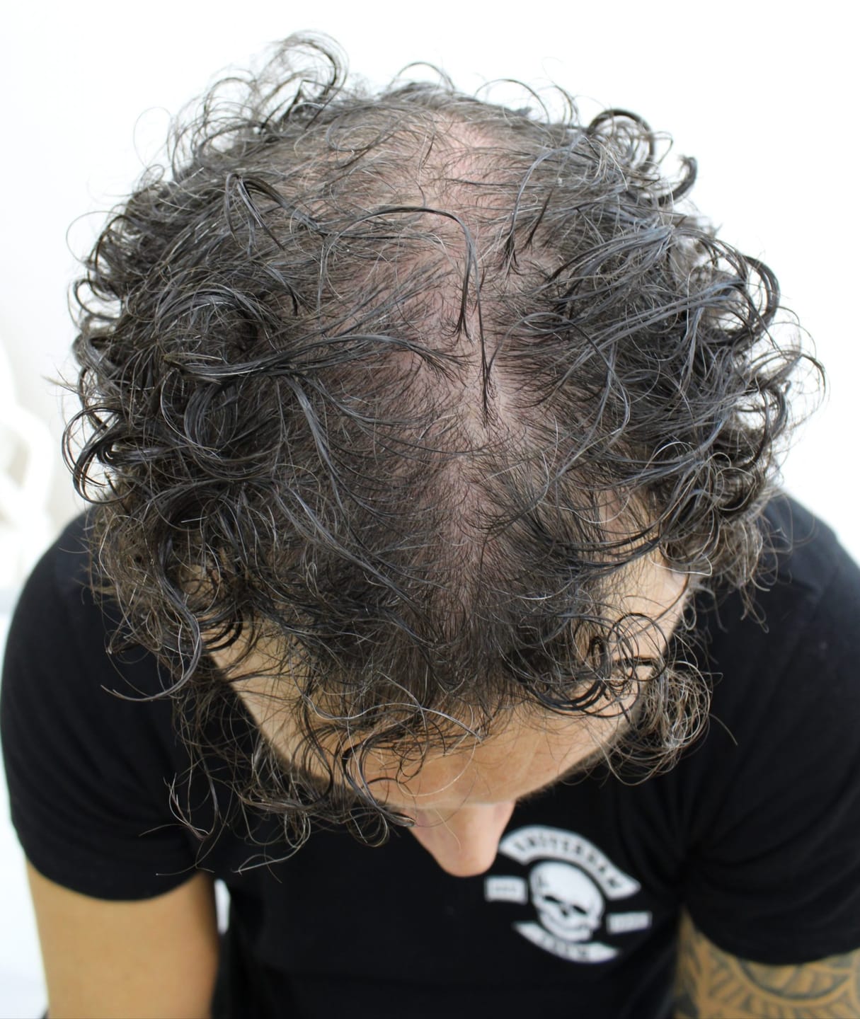 Customer photo review of Tónico Capilar de Romero  · Crecimiento y Anticaída