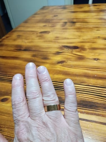 Customer photo review of Healing Ring