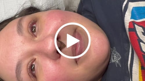 Customer photo review of Cysteamine Brow & Lash Lamination Kit - Step 1 - 15ml