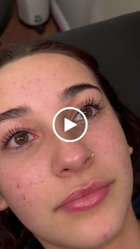 Customer photo review of Buff Lashes - VitaLash - 10ml