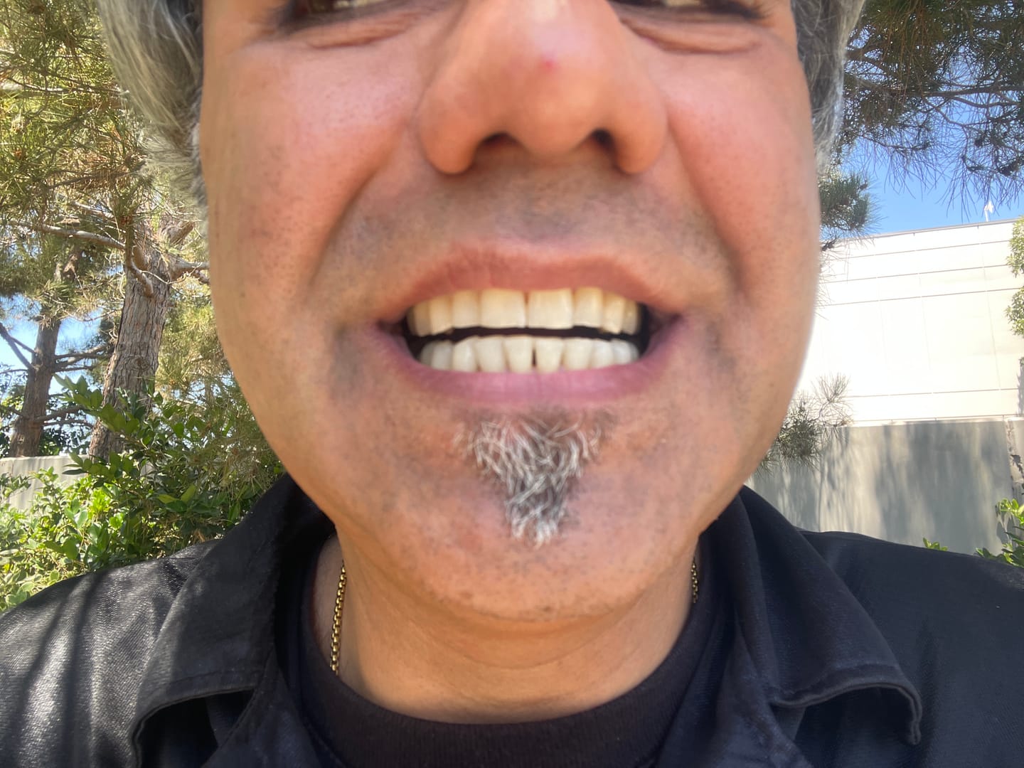 Customer photo review of File Your Smile (A Digital Copy of Your Impressions For Future Replacement Products)