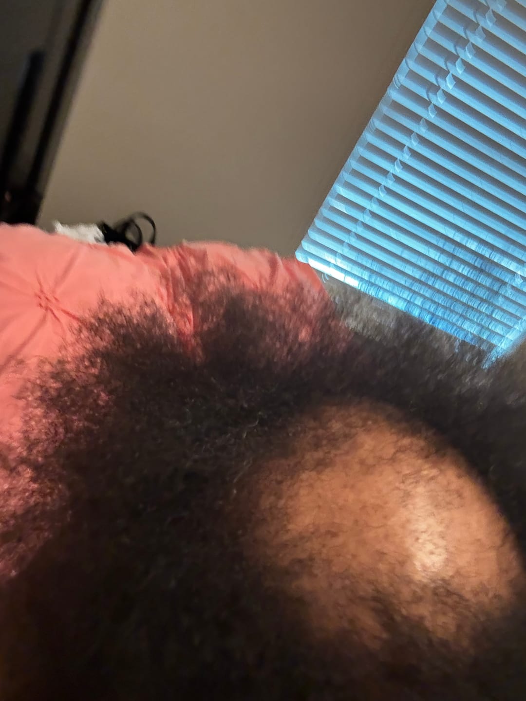 Customer photo review of Hair Growth Bundle