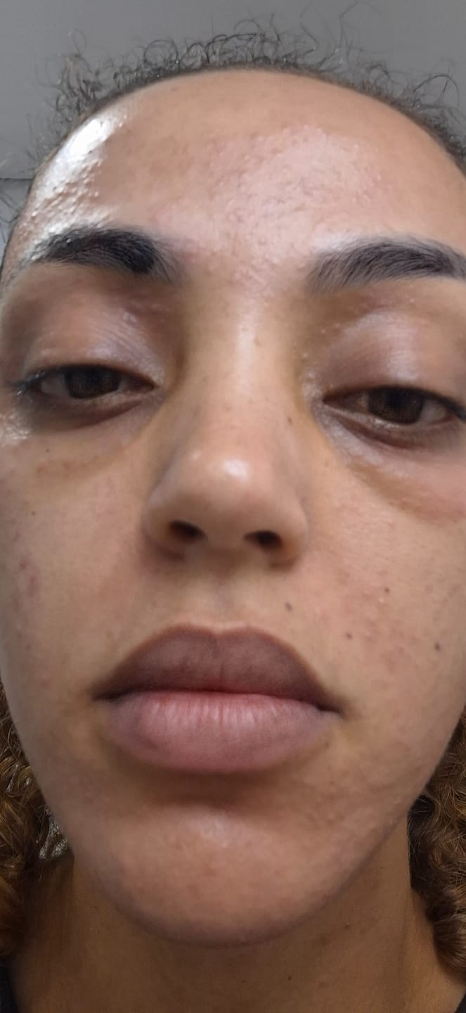 Customer photo review of Solução Retinol-Like