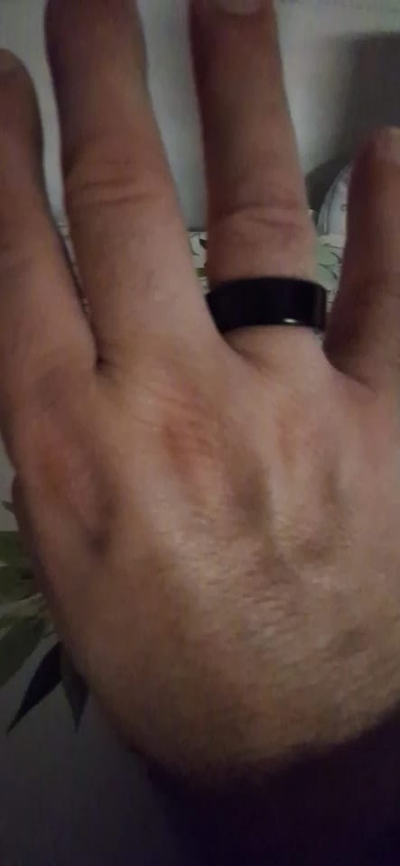Customer photo review of Smart Ring For Men & Women – Heart Rate & Blood Oxygen Monitoring