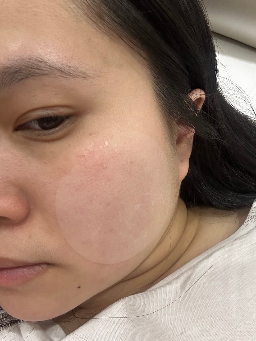 Customer photo review of Blemish Away Spot Mask
