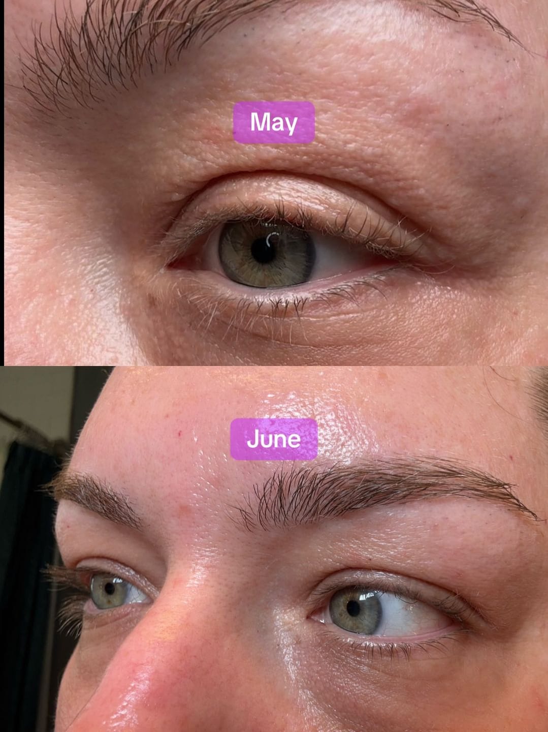 Customer photo review of Eyelash Serum