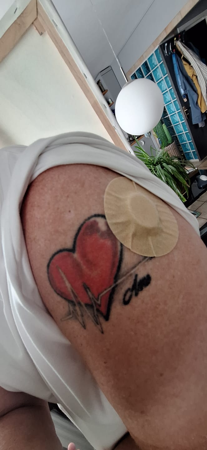 Customer photo review of Freestyle Libre 1,2 och 3 Beige sensor overpatches