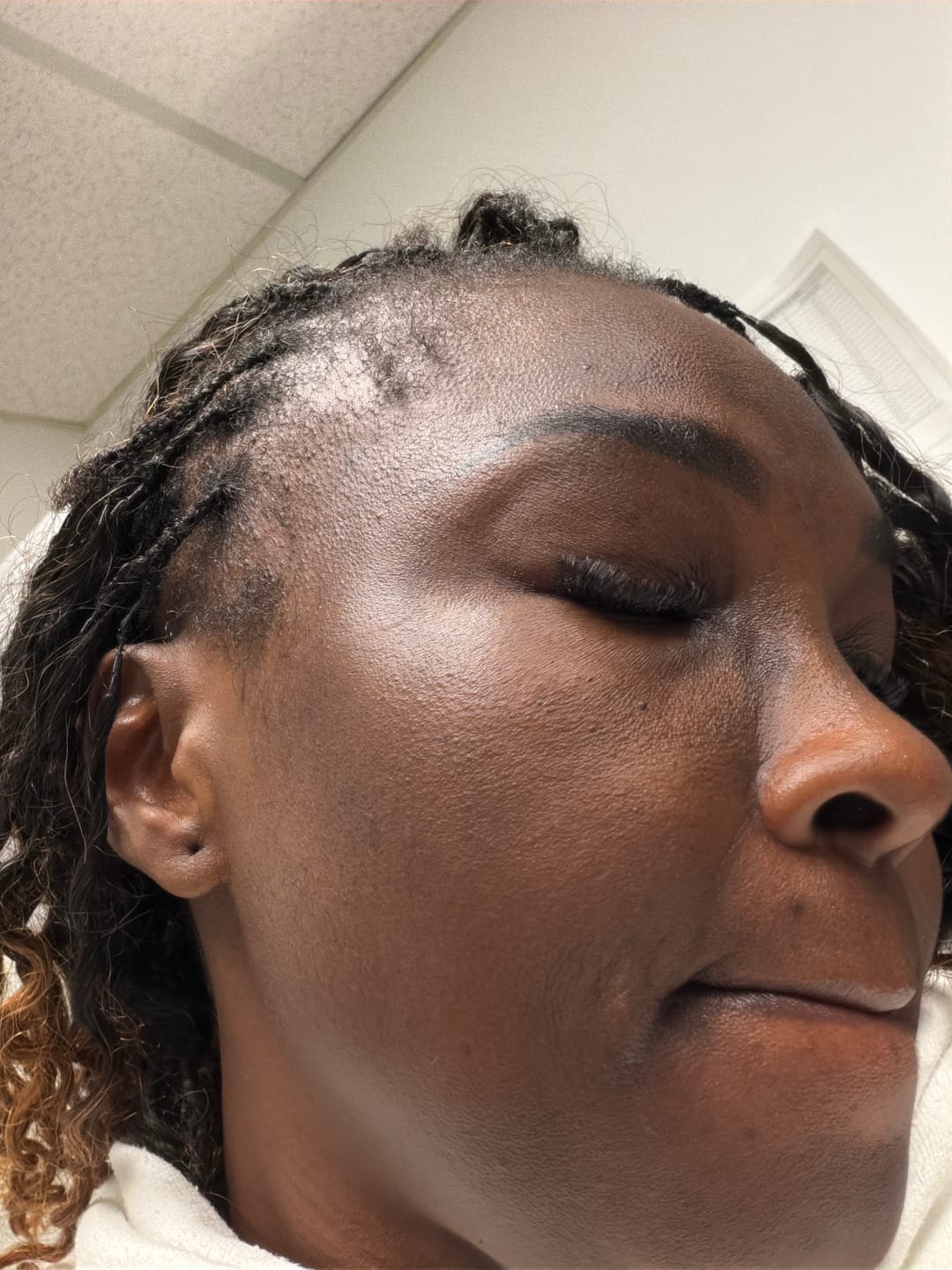Customer photo review of Sérum Vitamine C et Acide Hyaluronique Anti-Taches