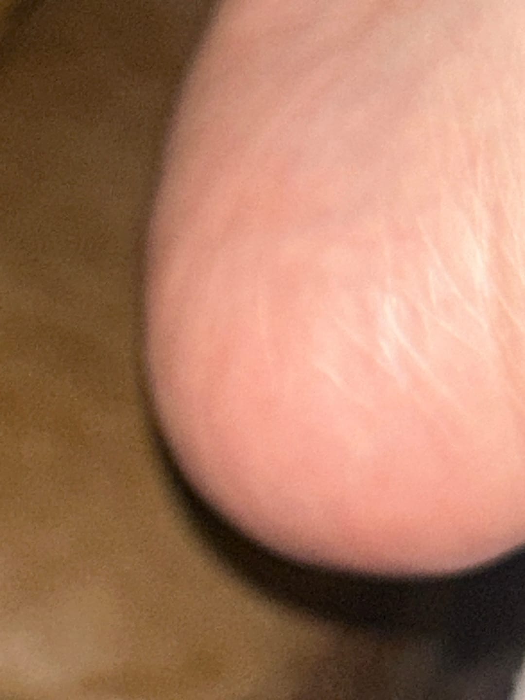 Customer photo review of Glowxie Salicylic Acid Reviving Foot Cream
