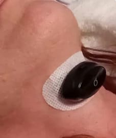 Customer photo review of NeuroAir™ — Eliminates Snoring & Sleep Apnoea