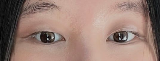 Customer photo review of Olens Glowy Brown Monthly Circle Lenses (2p)