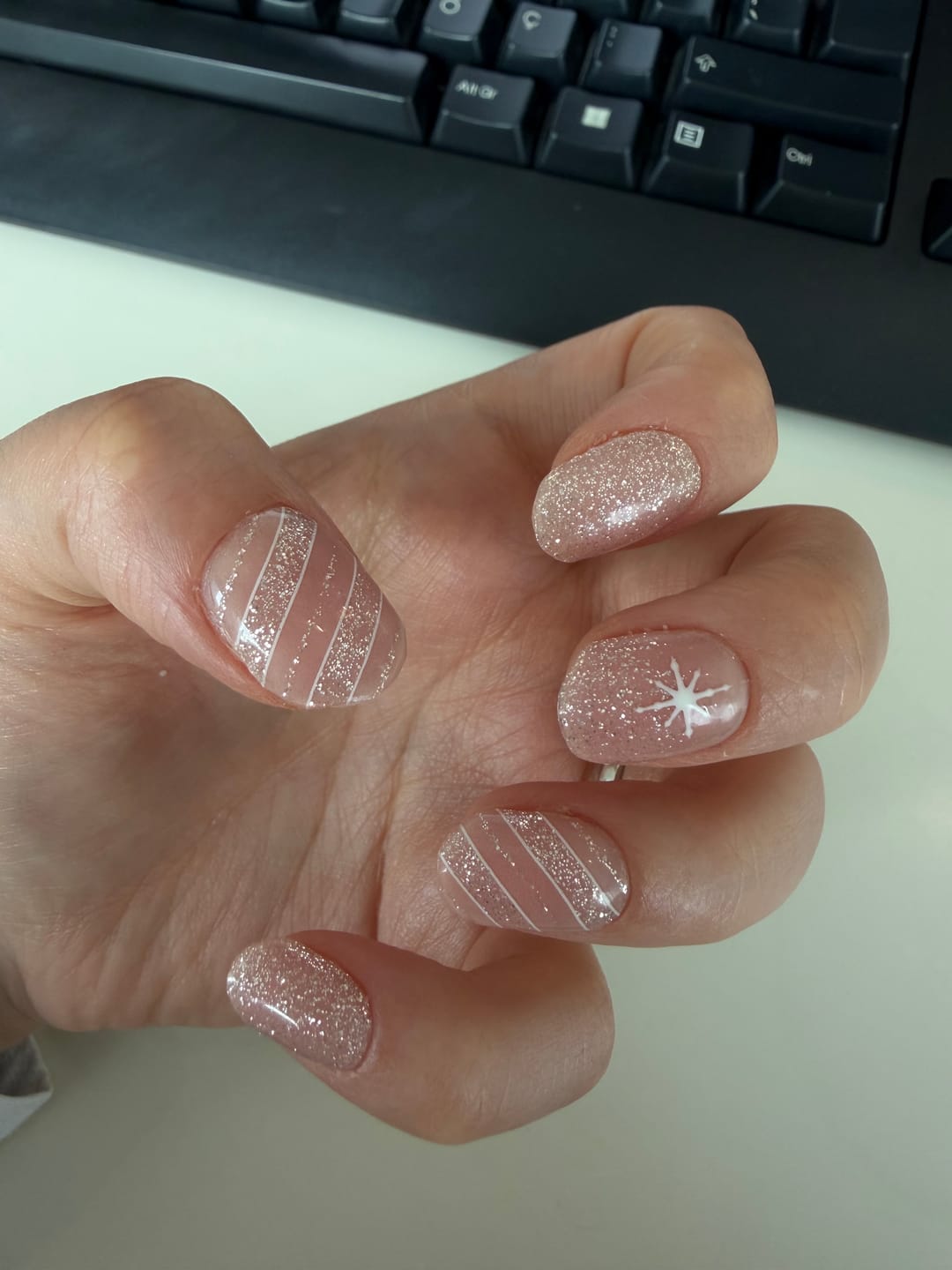 Customer photo review of N Crystal Frost Jel Tırnak 30 Adet, 2 Kullanım