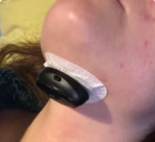 Customer photo review of NeuroAir™ — Eliminates Snoring & Sleep Apnoea