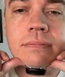 Customer photo review of NeuroAir™ — Eliminates Snoring & Sleep Apnoea