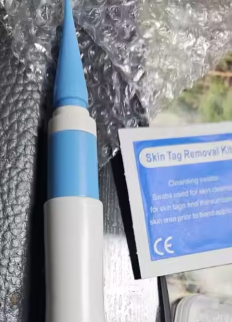 Customer photo review of Skin Tag Remover