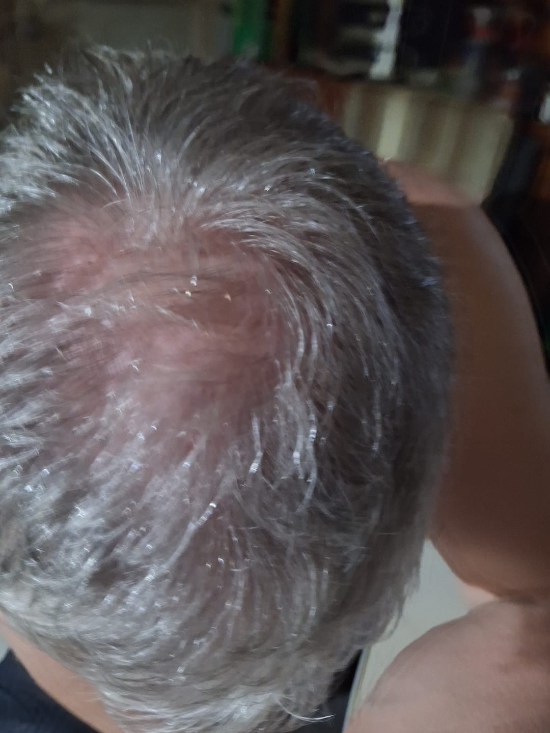 Customer photo review of Spartan™ Root Activator Shampoo 3 Bottles(sc)