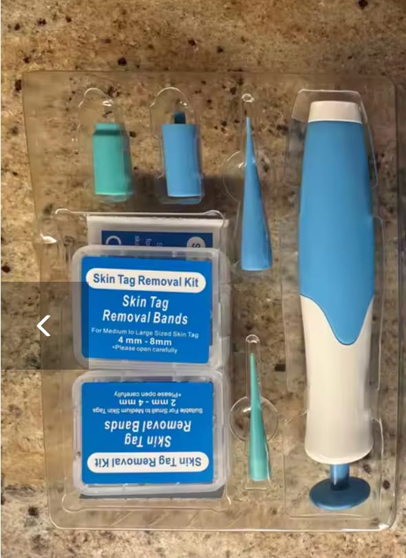 Customer photo review of Skin Tag Remover