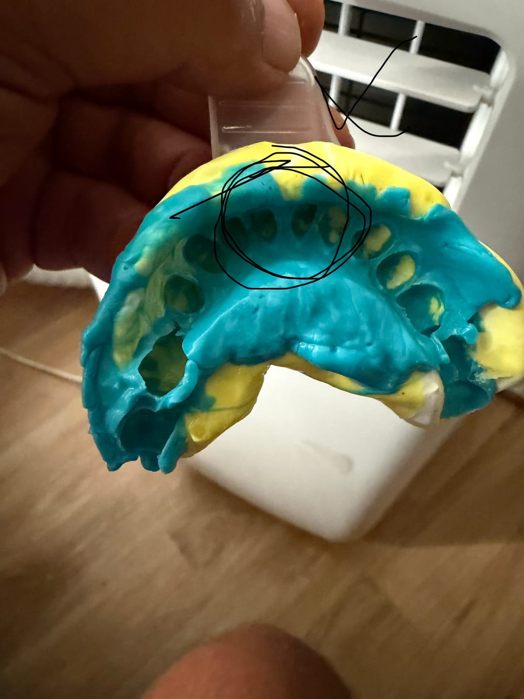 Customer photo review of Facette-Dentaire 3.0