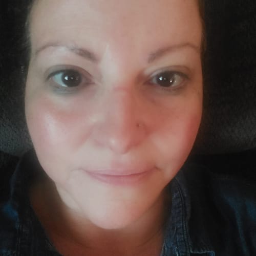 A customer's face showing fresh, plump skin after using The Micro Infusion System.