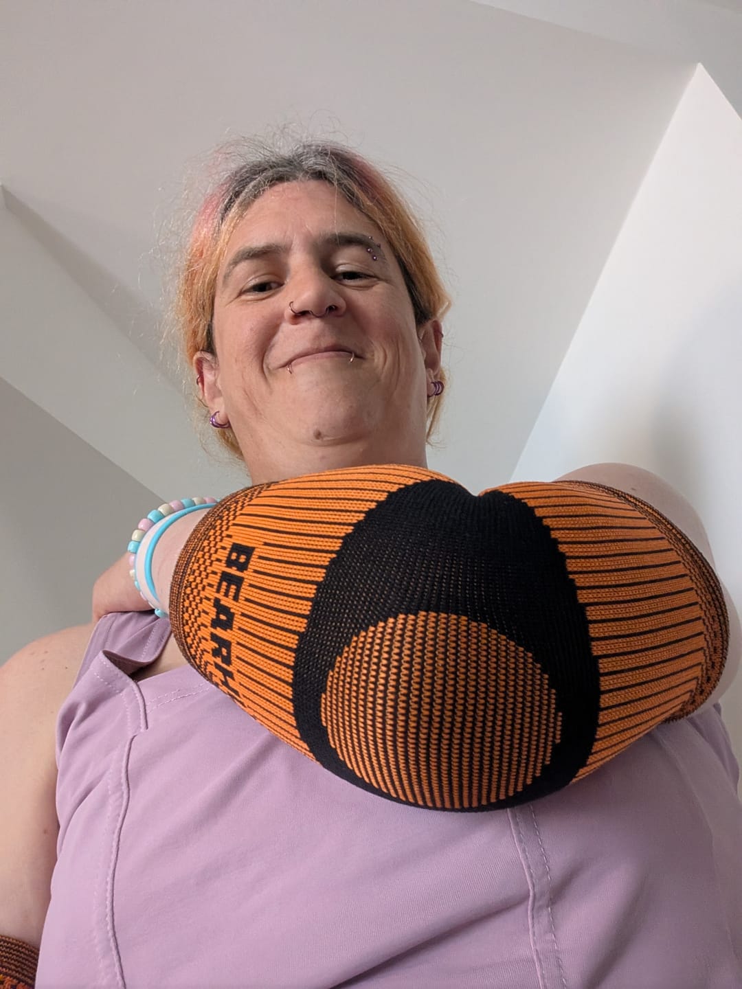 Customer photo review of Pair of Elbow Supports For Tennis Elbow Recovery
