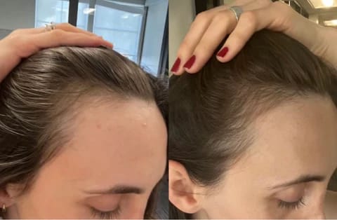 Customer photo review of Hair Growth Nourishing Spray