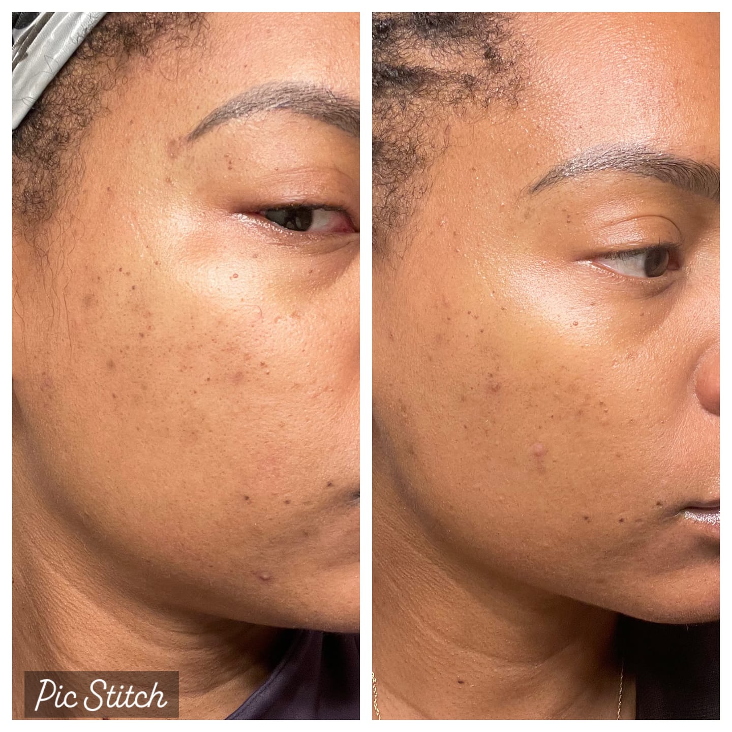 Customer photo review of Turmeric and Kojic Foaming Face Wash