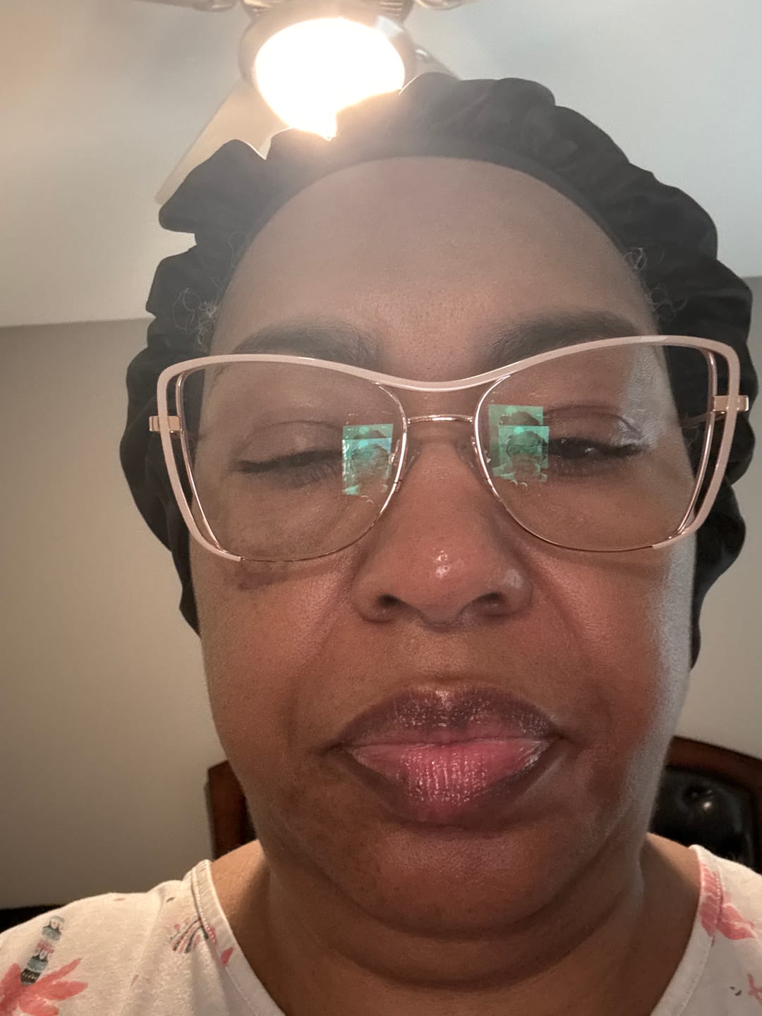 Customer photo review of Turmeric and Lemon Lip Balm (for Dark Lips)