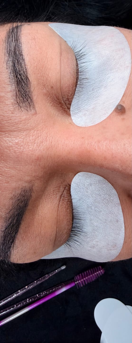 Customer photo review of 50PC Under Eye Gel Pads