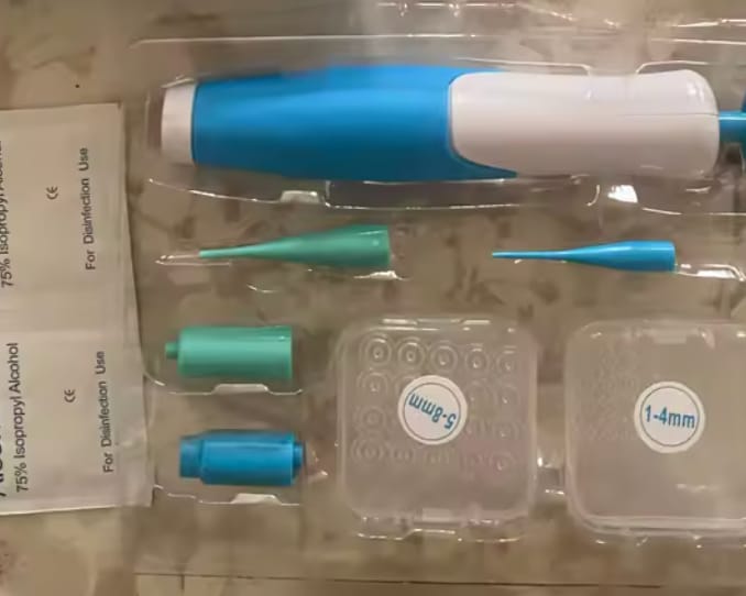 Customer photo review of Skin Tag Remover