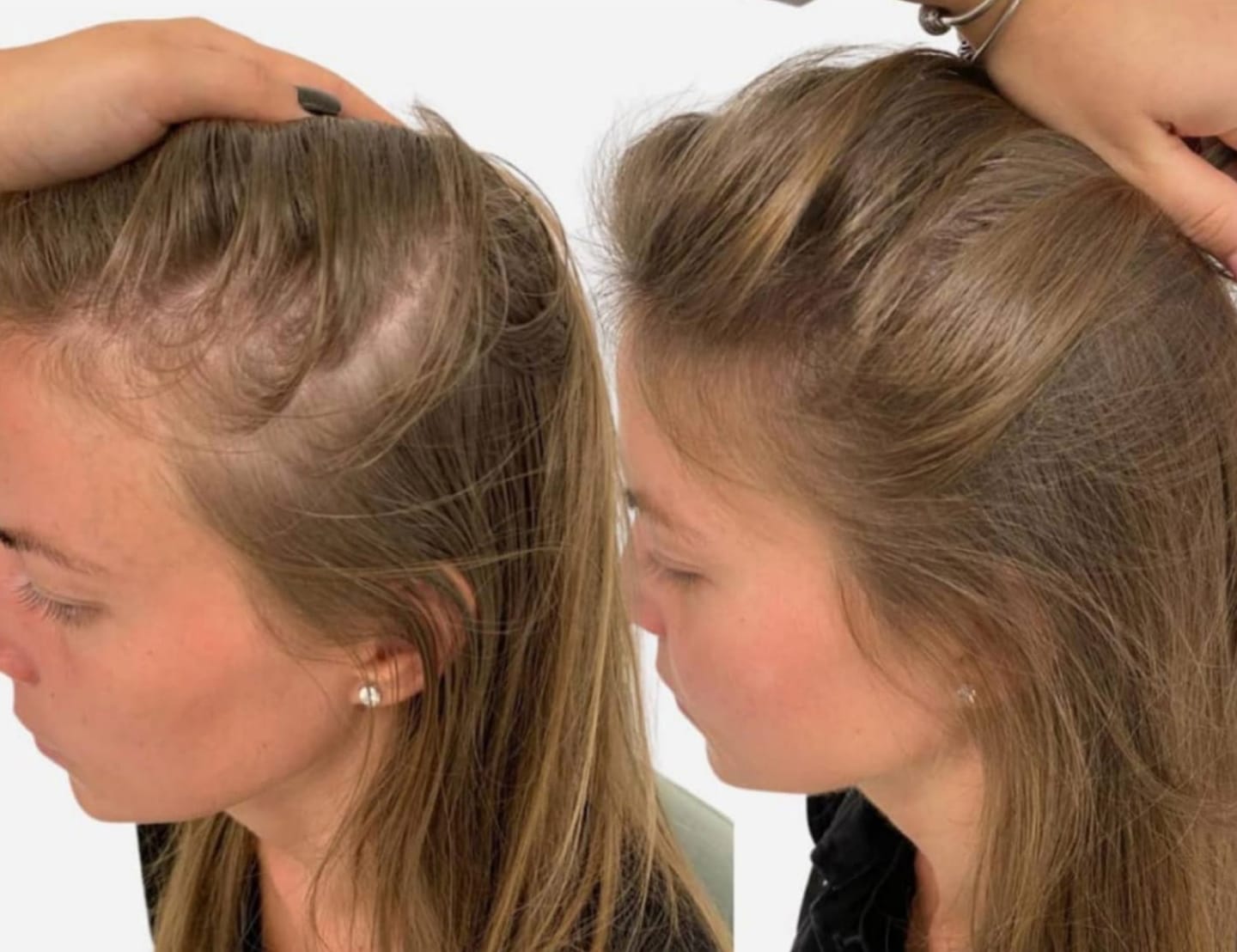 Customer photo review of Hair Growth Nourishing Spray