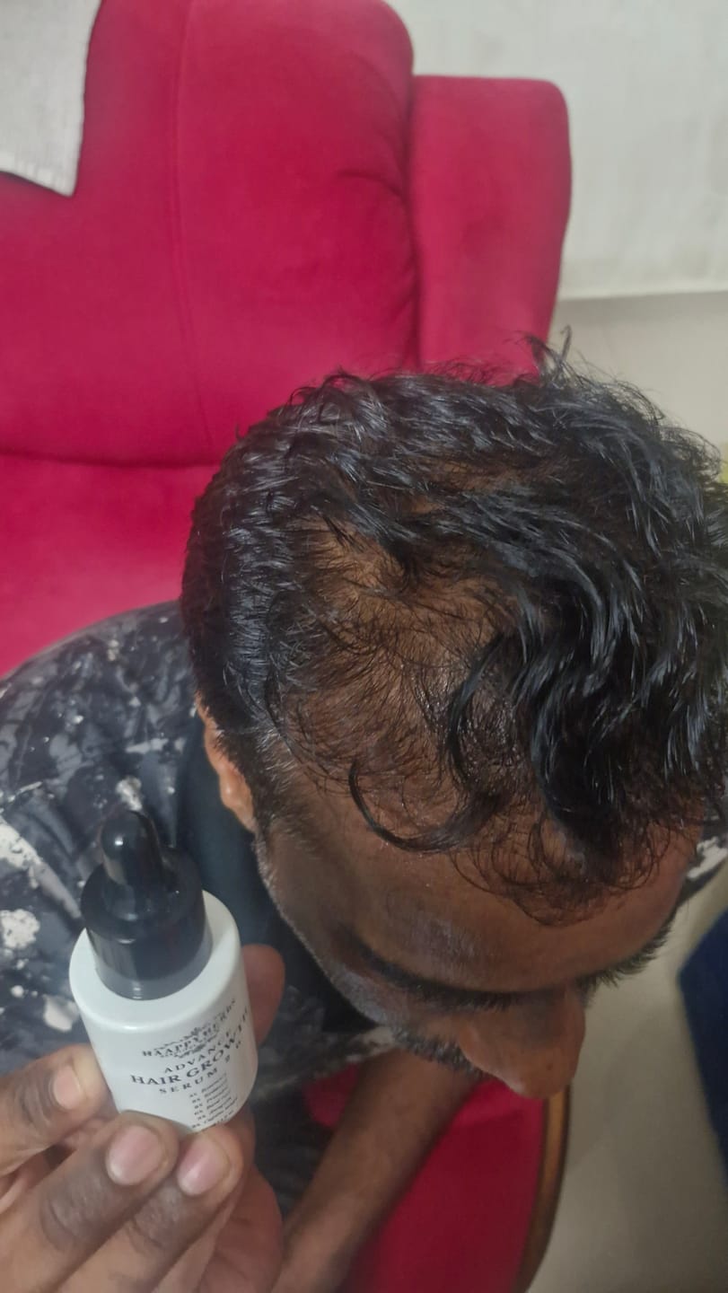 Customer photo review of Advance Hair Growth Serum 2.0 (30ml)