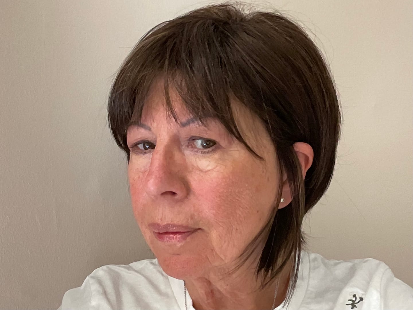 Customer photo review of Rosalique 3 in 1 Anti-Redness Miracle Formula SPF50