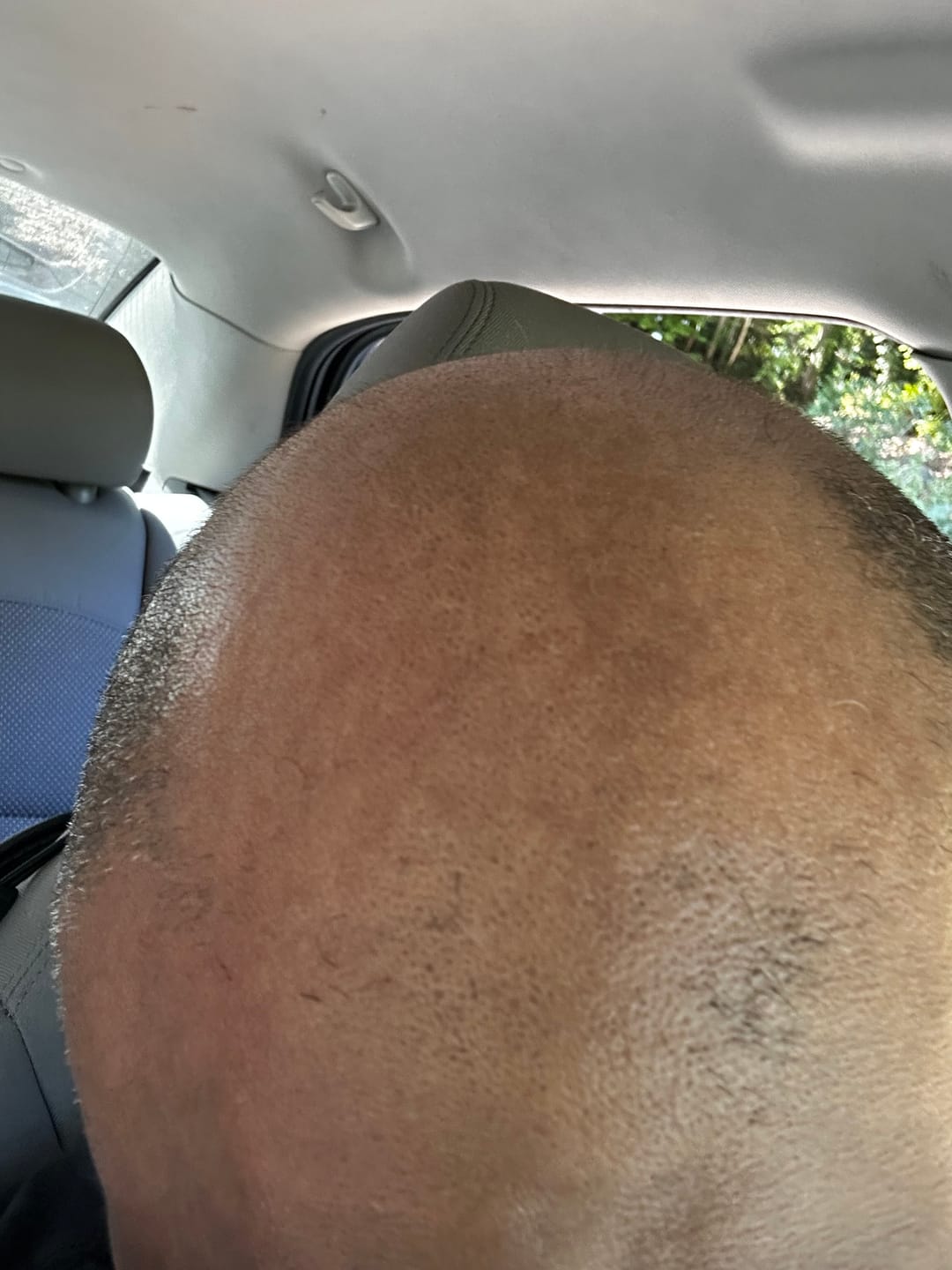 Customer photo review of Spartan™ Root Activator Shampoo 3 Bottles(sc)