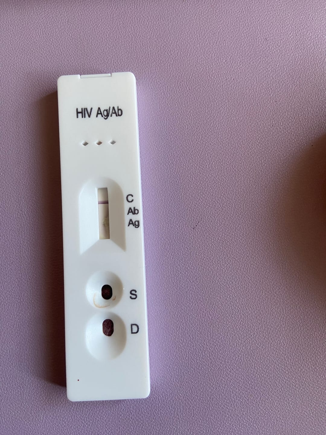 Customer photo review of STD自宅検査｜HIV(エイズ) 検査キット