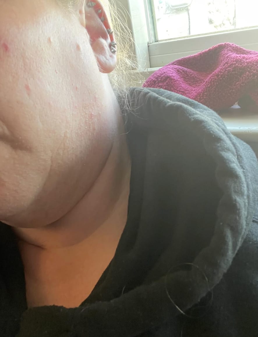 Customer photo review of Aceite botánico anti-crecimiento |     Alternativa natural a los láseres