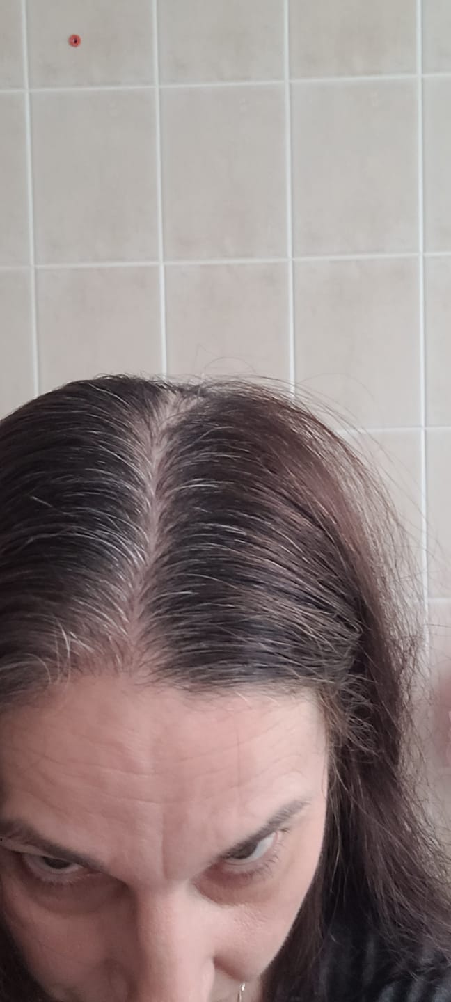 Customer photo review of Savon Anti-Chute| 12 Plantes Coréennes Naturelles