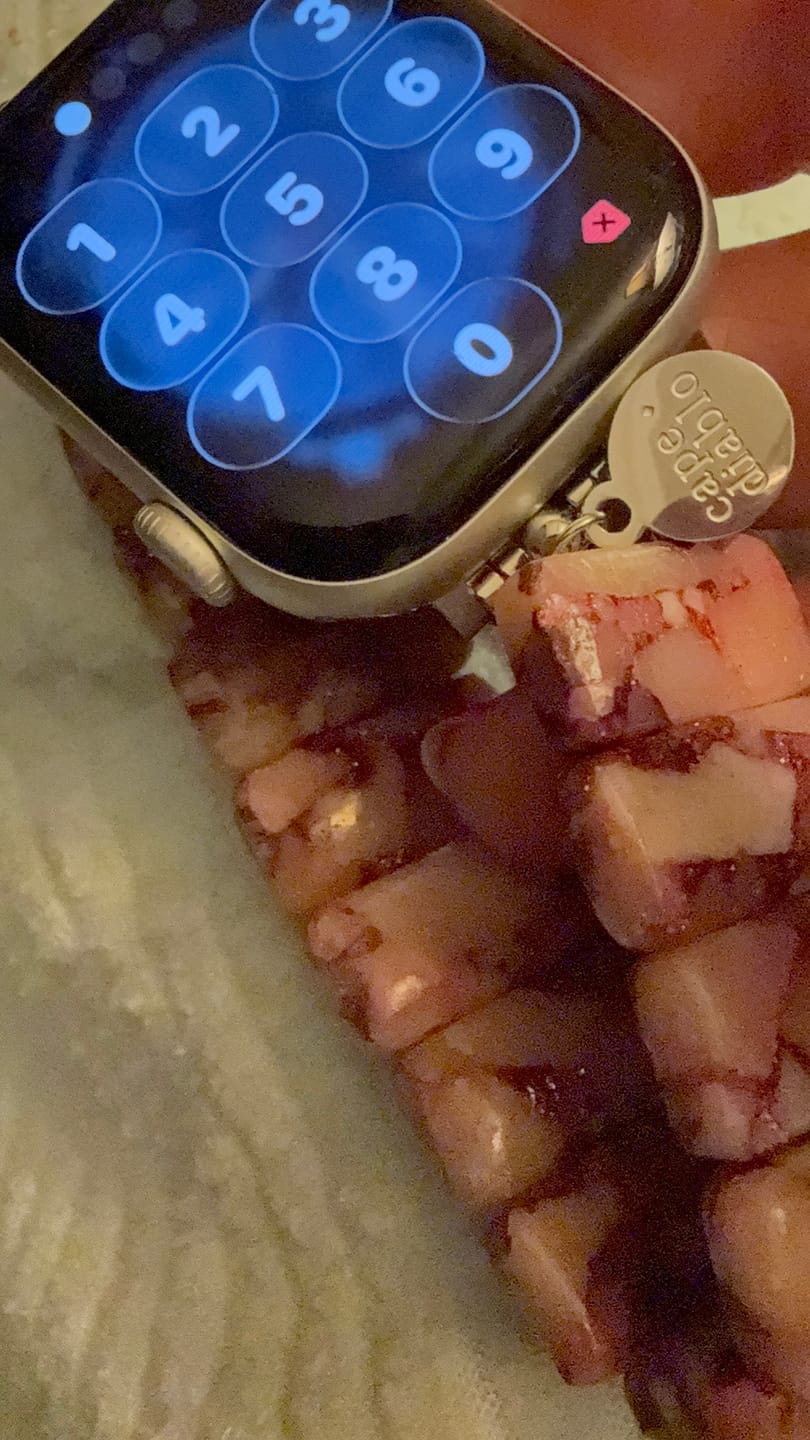 Customer photo review of Rose Marble Stretch Apple Watch Strap
