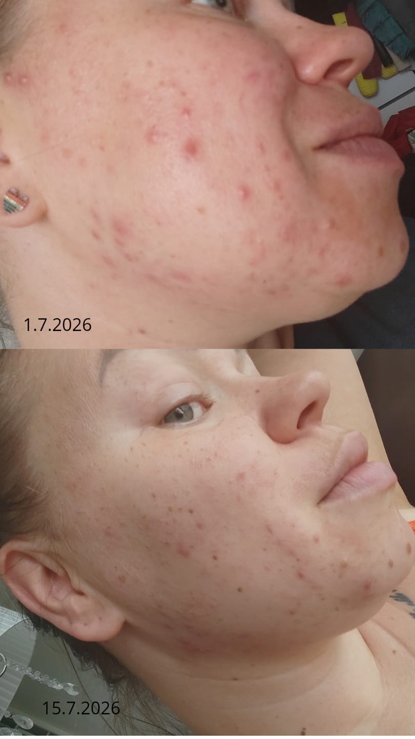 Customer photo review of Silky Sage Talivoide