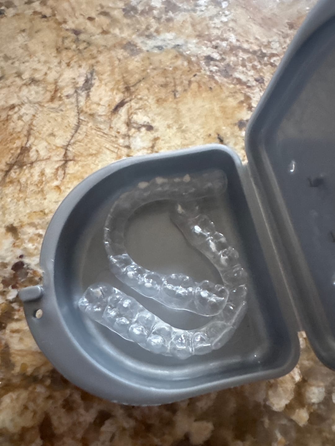 Customer photo review of Dental Pod Pro