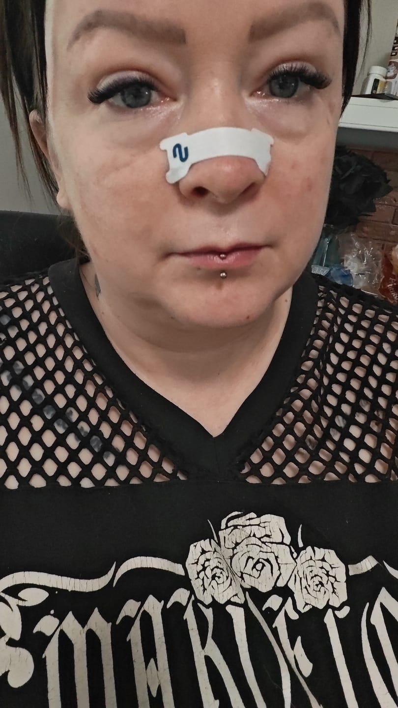 Customer photo review of Nuku Sleep Nasal Strips