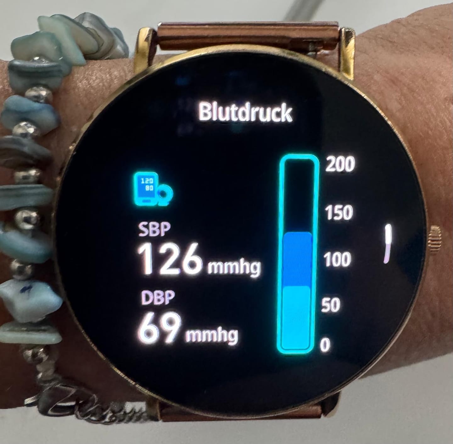 Customer photo review of Aurora™ Smartwatch
