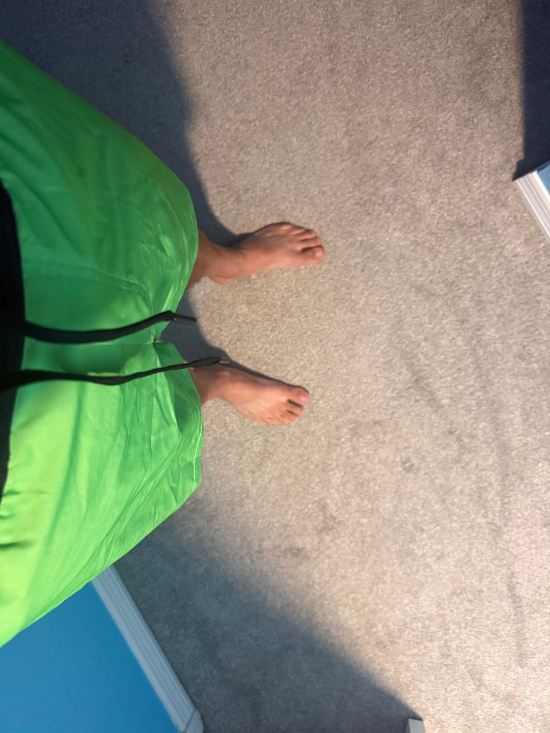 Customer photo review of Radioactive – V1 Lined Training Shorts