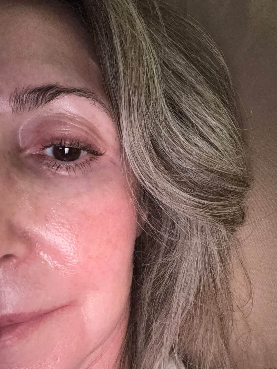 Customer photo review of 10% Tranexamic Acid Face Serum For Any Dark Spot 30ml