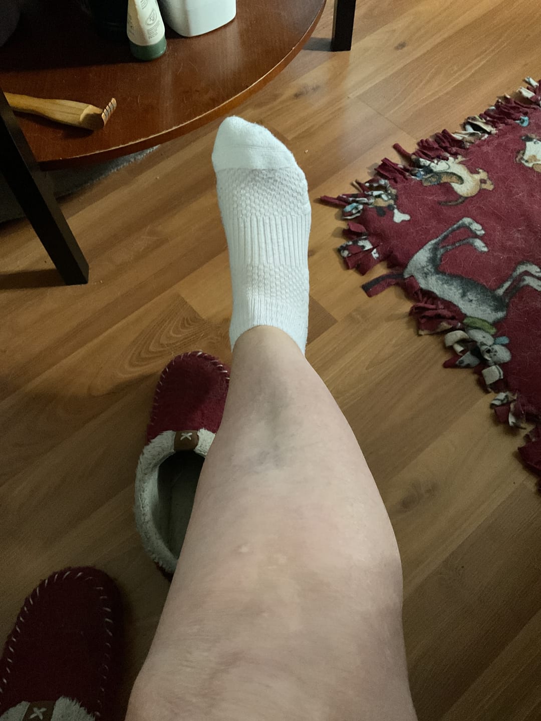 Customer photo review of White Ankle Compression Socks 5-Pack Bundle