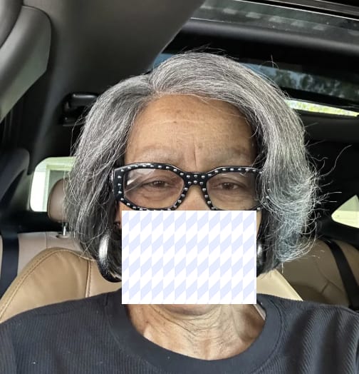 Customer photo review of Luvwin Salt And Pepper 5x5 Closure Pixie Cut Side Part Glueless Wig