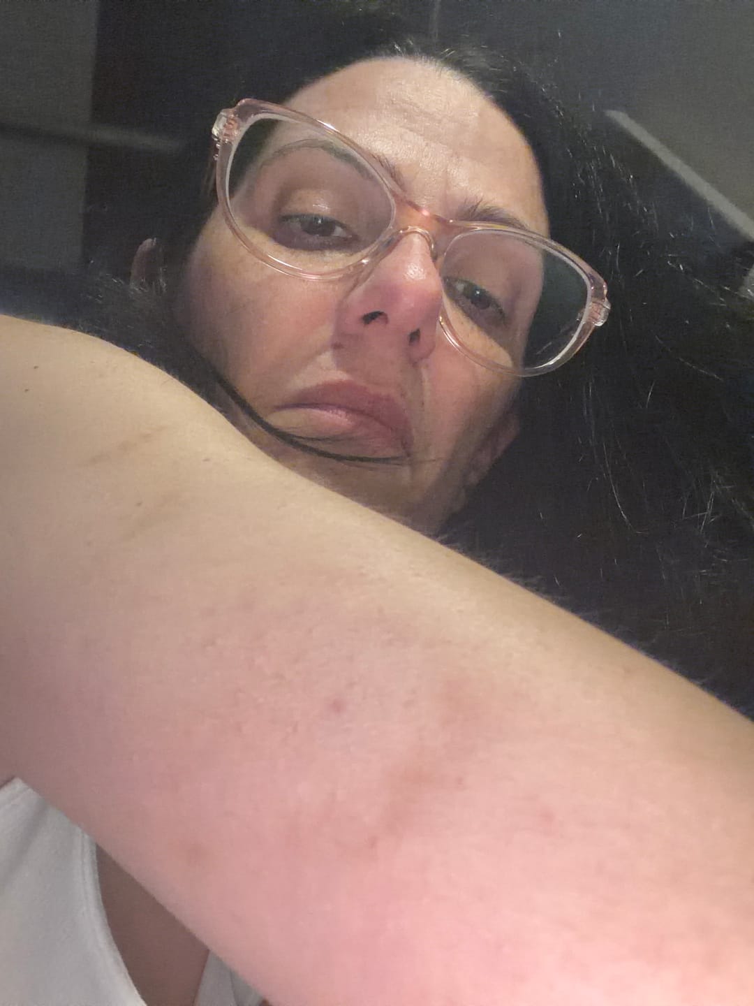 Customer photo review of Skin Defender Reusable Non-Adhesive Barrier - 5 Pack