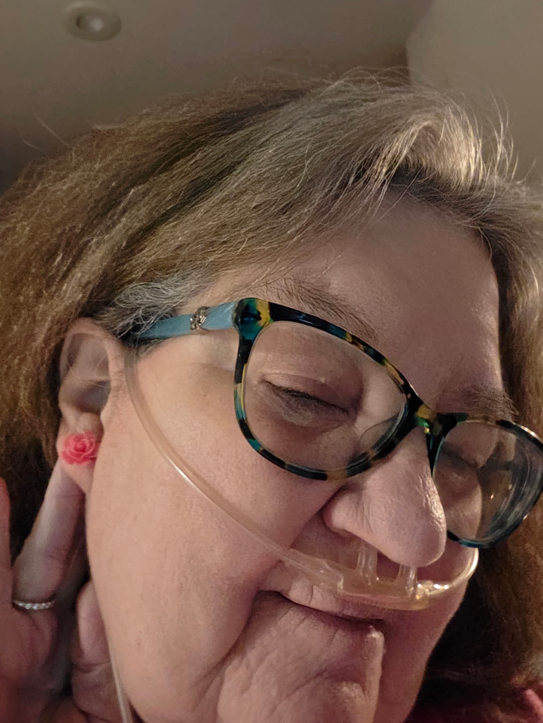 Customer photo review of Large Rose Studs Hypoallergenic Earrings for Sensitive Ears with Plastic Posts