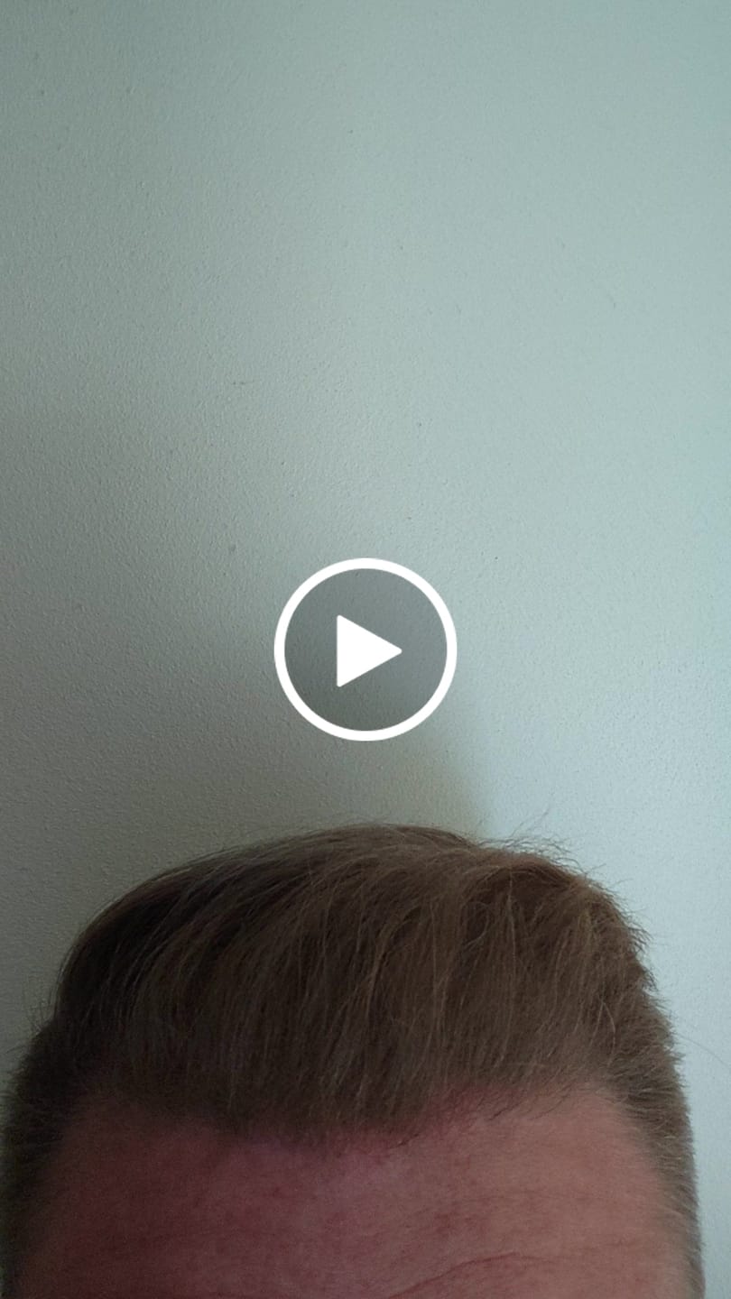 Customer video review of 6 Dosen IMPERIO® Streuhaar + 2 Gratis Dosen | (Sparangebot M)